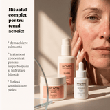 Tratament Complet DermaSolutions (Acnee)