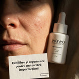 DermaSolutions Booster Acnee 100% molecular skincare