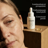 Tratament DermaSolutions pentru depigmentare, înălbire, iluminare